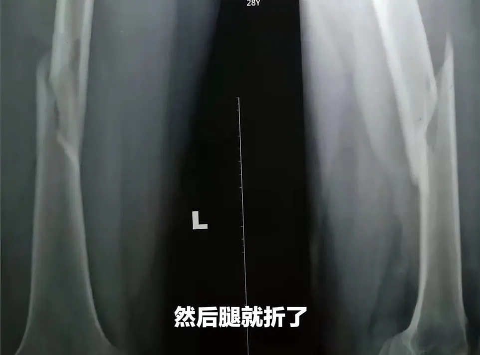 健身房被私教拉断腿_健身房劈腿_健身教练撕腿